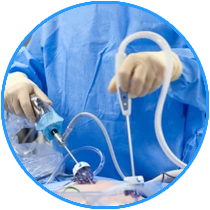 Advanced Laparoscopic Surgery