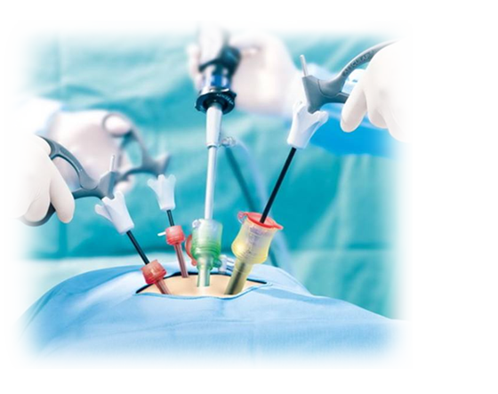 Advanced Laparoscopic Surgery doctor in hyderabad