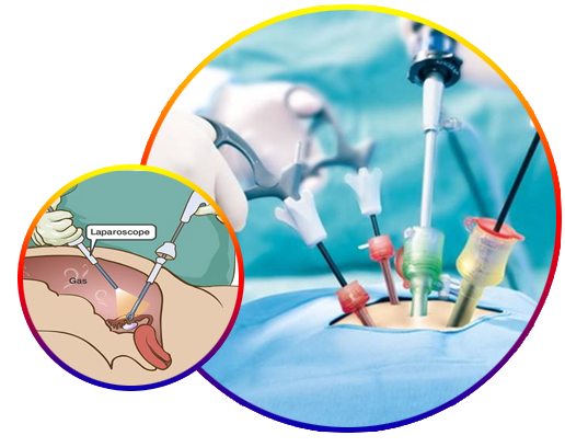 Advanced Laparoscopic Surgery 