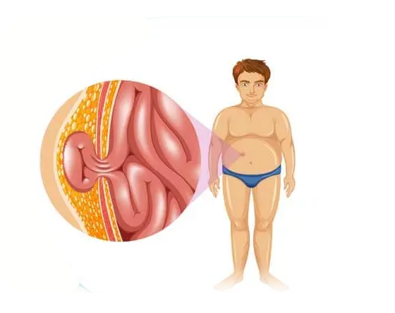 Hernia Surgery best doctor in hyderabad